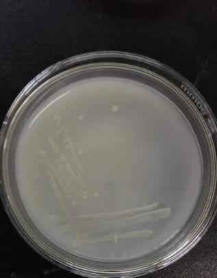解磷菌是什么菌？解磷微生物种类及分布