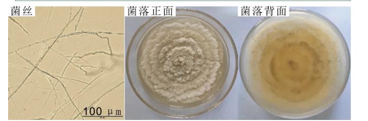 柑桔砂皮病菌座壳菌生长条件及纳米药剂筛?。ㄒ唬? title=