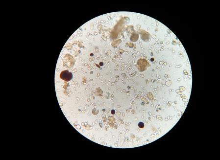 ?土壤中有哪些微生物？土壤微生物在生态系统中的作用