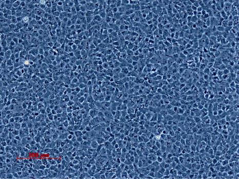 草鱼性腺细胞系生长曲线测定及对鲤春病毒血症病毒敏感性研究（一）