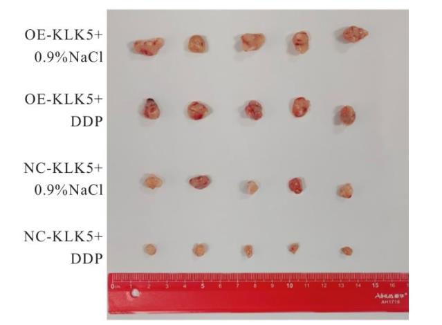 ?KLK5过表达促进宫颈癌移植瘤生长曲线并降低顺铂化疗敏感性的实验研究（二）