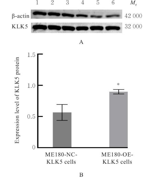 ?KLK5过表达促进宫颈癌移植瘤生长曲线并降低顺铂化疗敏感性的实验研究（一）