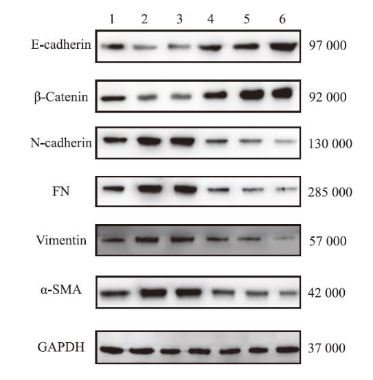 红景天苷对人肺腺癌细胞的上皮-间质转化的影响及作用机制（三）